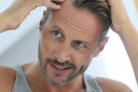 Hair loss and Vitamins