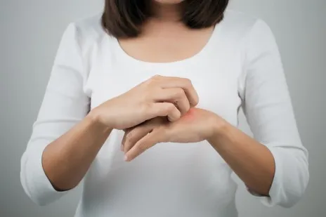 The 5 basic Facts of Eczema