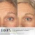 Medik8 Exo-PDRN Prismatic+ : PDRN and Exosomes Explained