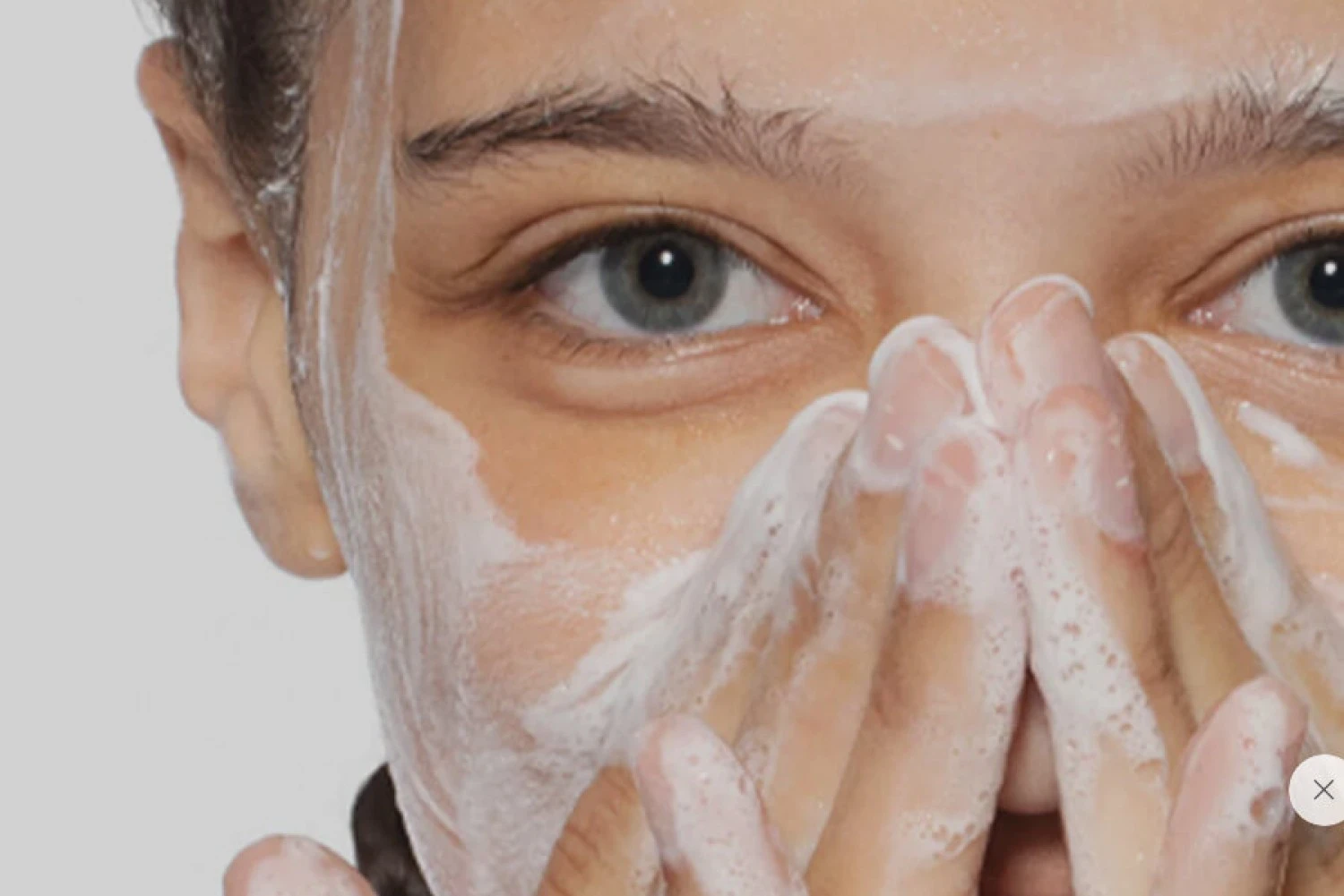 Sebaceous Filaments vs Blackheads