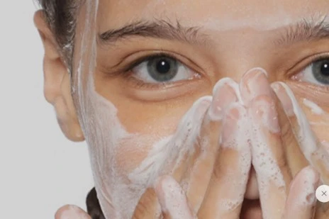 Sebaceous Filaments vs Blackheads