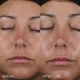 Image Skincare Daily Prevention Ultra Defence Moisturizer Spf 50 28g Image Skincare Daily Prevention Ultra Defence Moisturizer Spf 50 28g