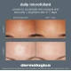 Dermalogica Daily Microfoliant Travel Size 13g