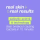 Dermalogica Clear Start Breakout Clearing Booster Dermalogica Clear Start Breakout Clearing Booster