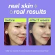 Dermalogica Clear Start Breakout Clearing Booster Dermalogica Clear Start Breakout Clearing Booster