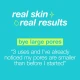 Dermalogica Clear Start Micro-Pore Mist 118ml Dermalogica Clear Start Micro-Pore Mist 118ml