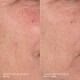 Dermalogica Skin Aging Solutions Kit Dermalogica Skin Aging Solutions Kit
