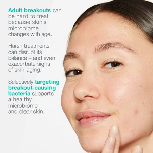 Dermalogica Active Clearing Breakout Biotic Moisturiser 50ml Dermalogica Active Clearing Breakout Biotic Moisturiser 50ml
