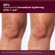Dermalogica Dynamic Skin Sculptor knees before and after Dermalogica Dynamic Skin Sculptor knees before and after