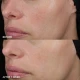 Image Skincare MD Barrier Repair Recovery Balm 57ml Image Skincare MD Barrier Repair Recovery Balm 57ml
