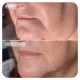 Image Skincare VOL.U.LIFT GLP-1 4D Skin Rebound Complex 57g