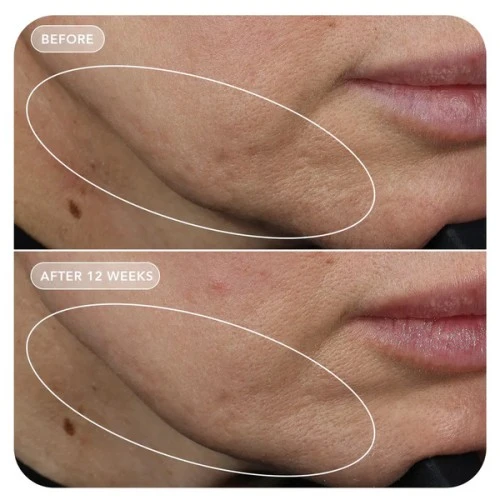 Image Skincare VOL.U.LIFT GLP-1 4D Skin Rebound Complex 57g
