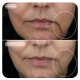 Image Skincare VOL.U.LIFT GLP-1 4D Skin Rebound Complex 57g