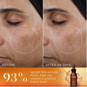 Medik8 Super C Ferulic 30ml Medik8 Super C Ferulic 30ml