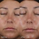 Image Skincare Daily Prevention Ultra Defense Moisturiser SPF 50 Image Skincare Daily Prevention Ultra Defense Moisturiser SPF 50