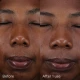 Before and after Image Skincare Daily Prevention Pure Mineral Tinted Moisturiser Spf 30