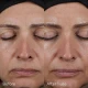 Before and after esults for Image Skincare Daily Prevention Advanced SmartBlend Mineral Moisturiser Spf 50