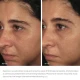 Image Skincare ORMEDIC Balancing Bio-Peptide Creme 57g Image Skincare ORMEDIC Balancing Bio-Peptide Creme 57g