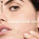 Vichy Normaderm Purifying Astringent Lotion 200Ml Vichy Normaderm Purifying Astringent Lotion 200Ml