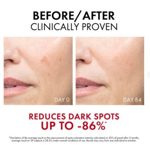 Vichy Liftactiv Specialist Serum B3 30ml Vichy Liftactiv Specialist Serum B3 30ml