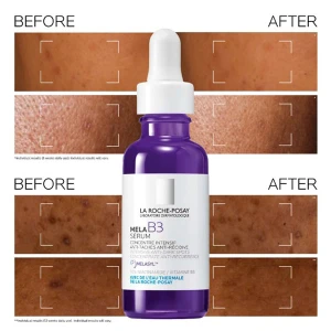 La Roche Posay Mela B3 Eye Cream 15ml La Roche Posay Mela B3 Eye Cream 15ml