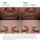 SkinCeuticals Cell Cycle Catalyst 30ml SkinCeuticals Cell Cycle Catalyst 30ml