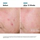 SkinCeuticals Advanced RGN-6 50ml SkinCeuticals Advanced RGN-6 50ml