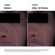 SkinCeuticals Anti Wrinkle P-Tiox Cream 48ml