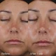 Image Skincare Daily Defense Bundle Image Skincare Daily Defense Bundle