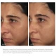 Image Skincare Sensitive Skin Sanctuary Bundle Image Skincare Sensitive Skin Sanctuary Bundle