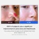 Medicube Zero Pore Pad 2.0 [70 Pads]