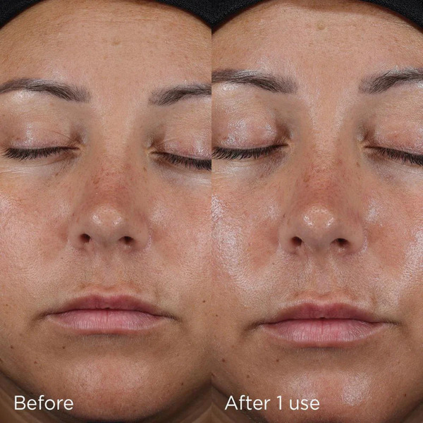 Image Skincare Daily Prevention Ultra Defence Moisturizer Spf 50 28g Image Skincare Daily Prevention Ultra Defence Moisturizer Spf 50 28g