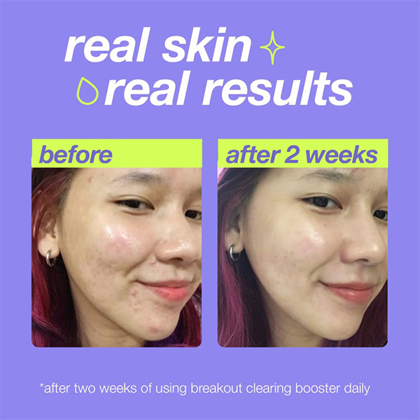 Dermalogica Clear Start Breakout Clearing Booster Dermalogica Clear Start Breakout Clearing Booster