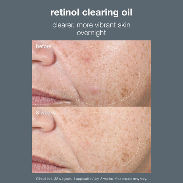 Dermalogica Active Clearing Retinol Clearing Oil 30ml Dermalogica Active Clearing Retinol Clearing Oil 30ml