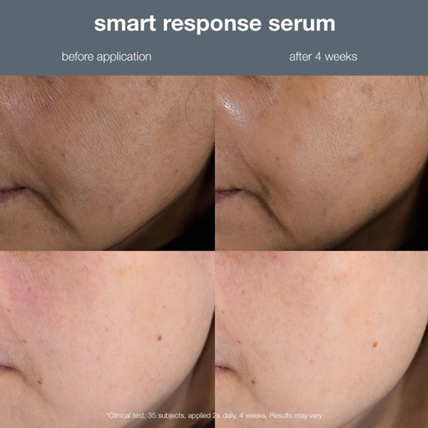 Dermalogica Smart Response Serum 30ml Dermalogica Smart Response Serum 30ml