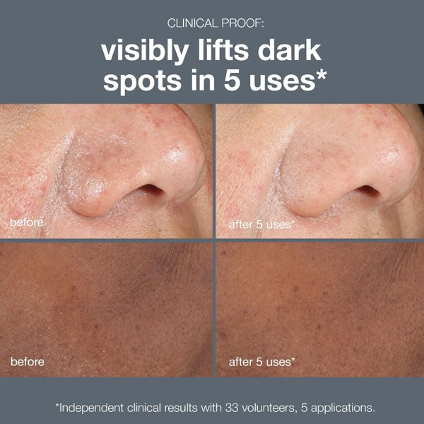 Dermalogica Powerbright Dark Spot Peel 50ml Dermalogica Powerbright Dark Spot Peel 50ml