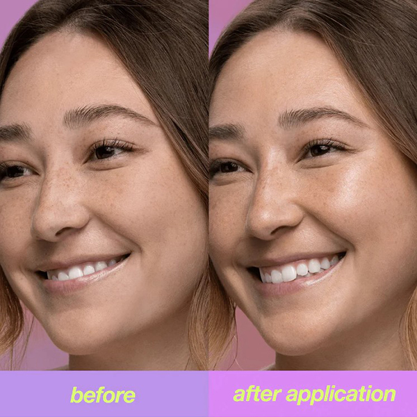 Modelshowing before and after Dermalogica Clear Start Golden Hour Hydrating Spf 30 Stick Modelshowing before and after Dermalogica Clear Start Golden Hour Hydrating Spf 30 Stick