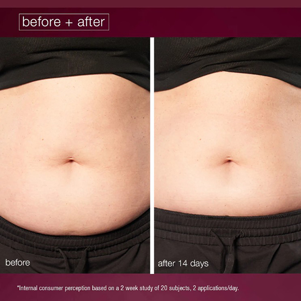 Stomach before & after with Dermalogica Dynamic Skin Sculptor Stomach before & after with Dermalogica Dynamic Skin Sculptor
