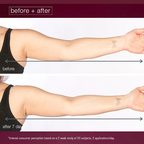 Dermalogica Dynamic Skin Sculptor arms before and after Dermalogica Dynamic Skin Sculptor arms before and after