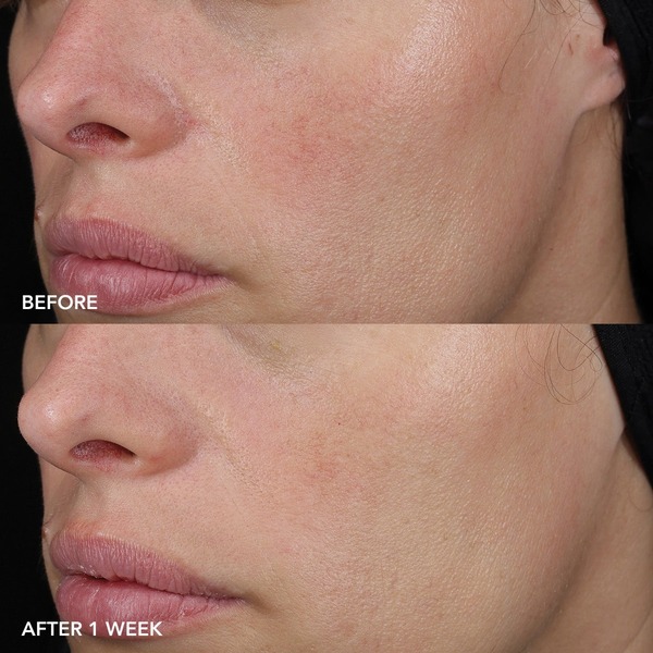 Image Skincare MD Barrier Repair Recovery Balm 57ml Image Skincare MD Barrier Repair Recovery Balm 57ml