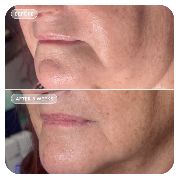 Image Skincare VOL.U.LIFT GLP-1 4D Skin Rebound Complex 57g