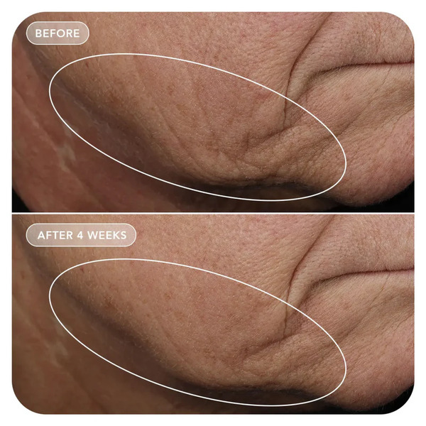 Image Skincare VOL.U.LIFT GLP-1 4D Skin Rebound Complex 57g