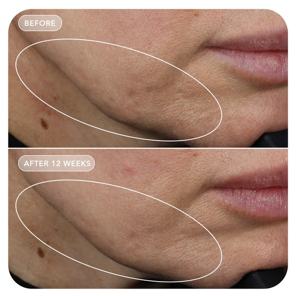Image Skincare VOL.U.LIFT GLP-1 4D Skin Rebound Complex 57g