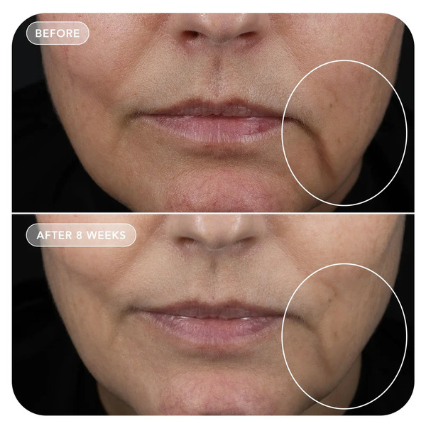 Image Skincare VOL.U.LIFT GLP-1 4D Skin Rebound Complex 57g