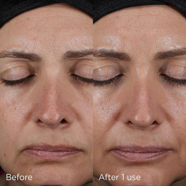 Before and after esults for Image Skincare Daily Prevention Advanced SmartBlend Mineral Moisturiser Spf 50
