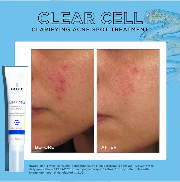 Image Skincare CLEAR CELL Clarifying Salicylic Blemish Gel 14g Image Skincare CLEAR CELL Clarifying Salicylic Blemish Gel 14g