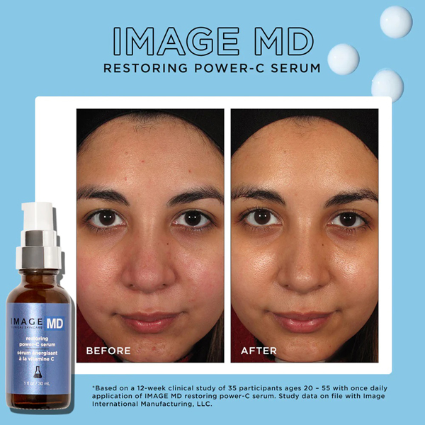 Image Skincare MD Restoring Power-C Serum 30ml Image Skincare MD Restoring Power-C Serum 30ml