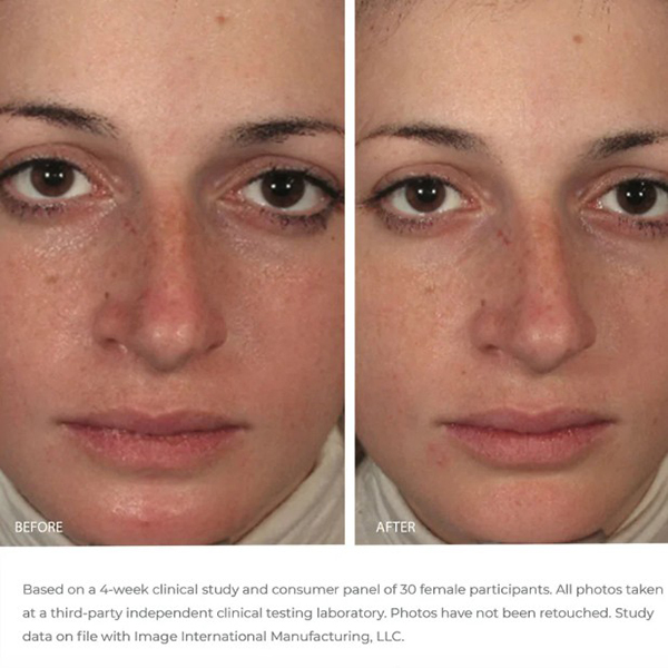 Image Skincare ORMEDIC Balancing Gel Masque 59ml Image Skincare ORMEDIC Balancing Gel Masque 59ml