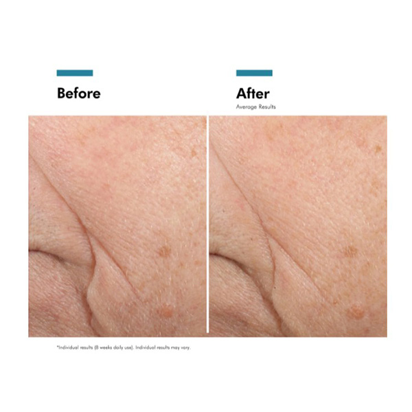 SkinCeuticals Triple Lipid Restore 2:4:2