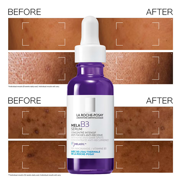 La Roche Posay Mela B3 Serum 50ml La Roche Posay Mela B3 Serum 50ml